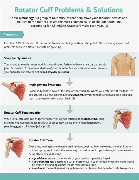 test rotator cuff tear|complete rotator cuff tear test.